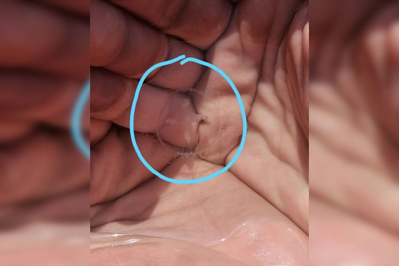 Medúzka na Zlatých pieskoch a Draždiaku, foto: FB Bratislavak