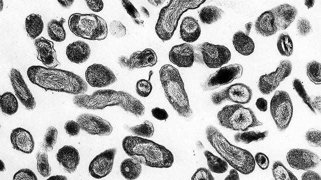 Slováci sa nakazili zriedkavou Q horúčkou: Aké sú jej príznaky?
