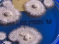 Európou sa šíri superpleseň. Môže to byť nová epidémia!